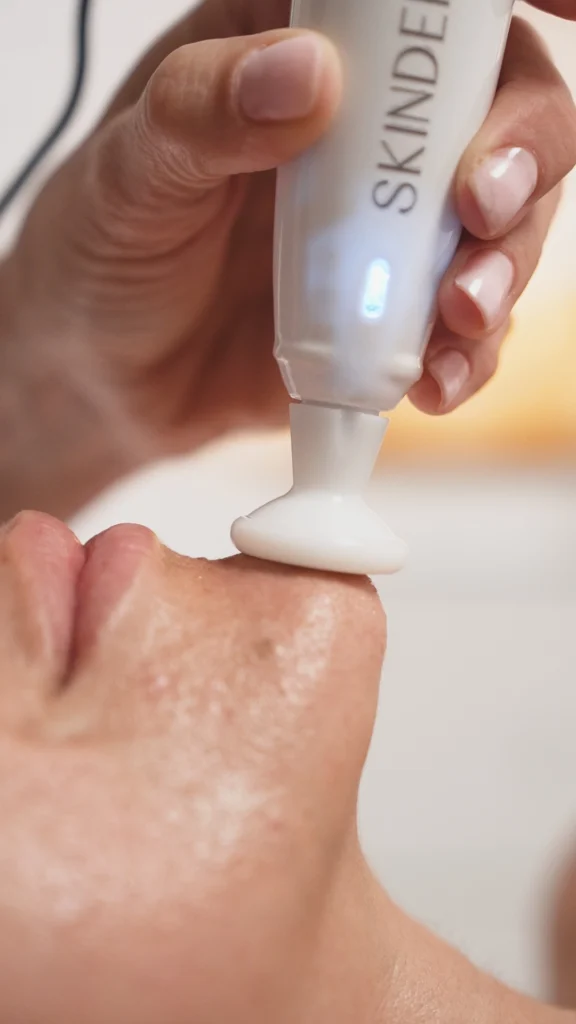 skd-skincure-21-skinderma
